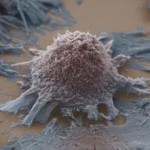 A foe requiring national action plans Wellcome Images Flickr